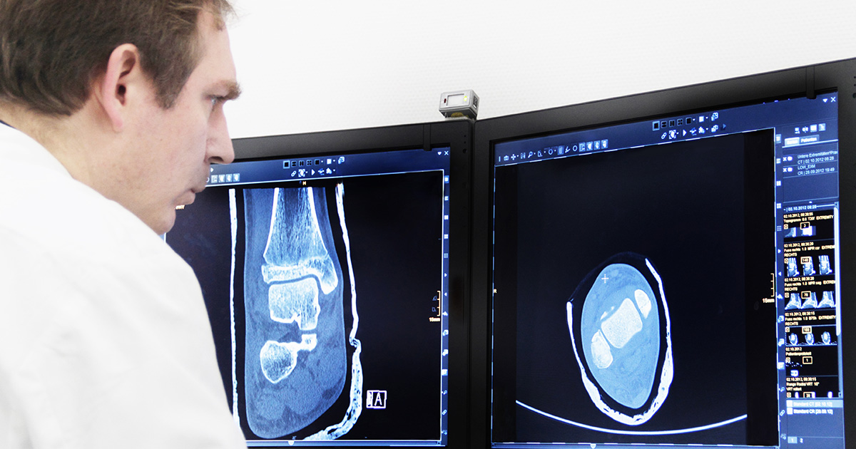 Radiologist examines X-ray