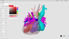 Arc Viewer, a 3D model viewing software for surgeons and other medical professionals