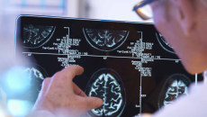 Image of a brain examined by a medical professional