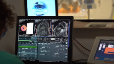 AI, Barts Health, NHS