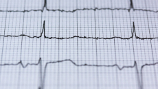 EKG read out