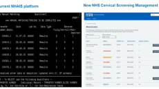 NHSX, cervical cancer