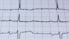 An EKG readout