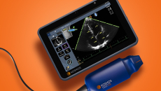 A handheld point-of-care ultrasound