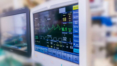 A monitor showing a patient's vitals during surgery