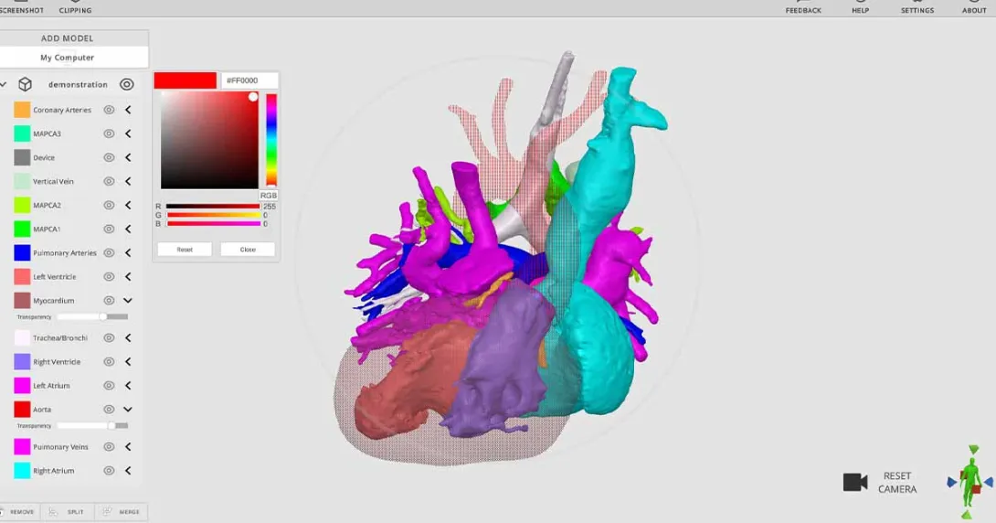 Arc Viewer, a 3D model viewing software for surgeons and other medical professionals