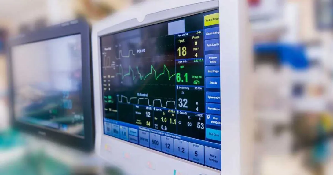 A monitor showing a patient's vitals during surgery