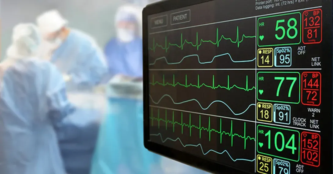heart monitor in a surgical theatre