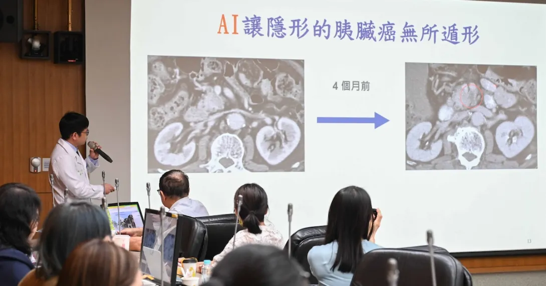 An NTUH researcher demonstrating their new pancreatic cancer detection AI tool