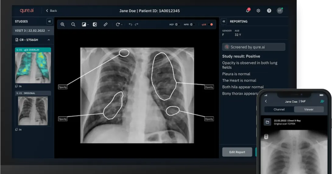 Desktop and mobile interface of a chest X-ray analysis software