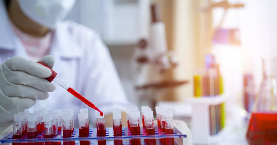 A laboratory assistant getting blood samples